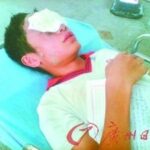技术宅不是人人能当 熊孩子自制闪光弹被晃瞎双眼